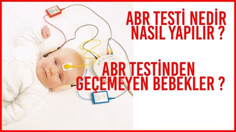 Bebeklerde bera testi nasıl yapılır